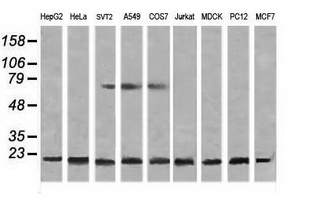 Western blot analysis of extracts (35ug) from 9 different cell lines by usin g anti-NDUFB10 monoclonal antibody (HepG2: human; HeLa: human; SVT2: mouse; A549: human; COS7: monkey; Jurkat: human; MDCK: canine; PC12: rat; MCF7: human)