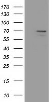 HEK293T cells were transfected with the pCMV6-ENTRY control (Left lane) or pCMV6-ENTRY MPP3 (Right lane) cDNA for 48 hrs and lysed