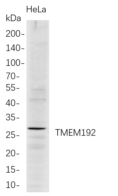 Western Blot analysis of HeLa whole cell lysates were separated by 4-20% SDS-PAGE, and the membrane was blotted with anti-TMEM192 rabbit mAb