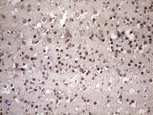 m11950 anti nup43 mouse monoclonal antibody clone id oti6f8 ihc testing 3
