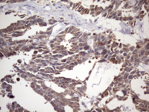 m11950 anti nup43 mouse monoclonal antibody clone id oti6f8 ihc testing 4