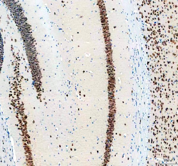 m11954 neun primary antibodies ihc testing 1
