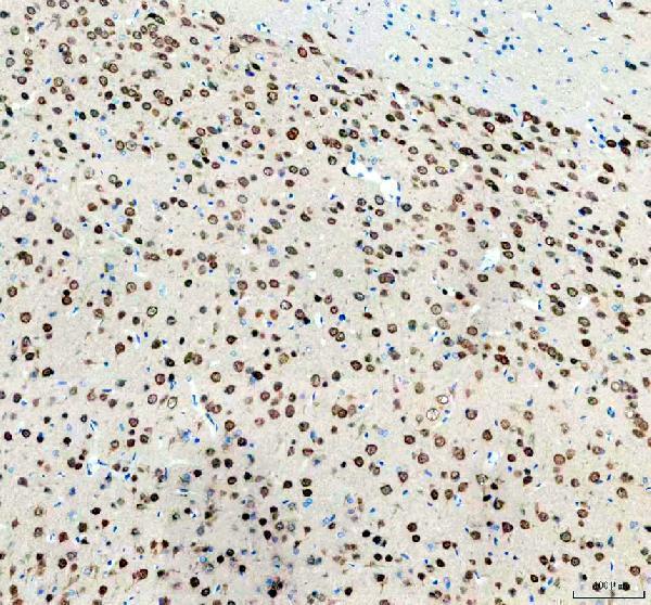 m11954 neun primary antibodies ihc testing 3