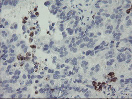 m11956 anti myl7 mouse monoclonal antibody clone id oti4e7 ihc testing 2
