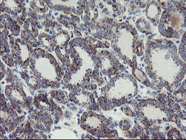 m11956 anti myl7 mouse monoclonal antibody clone id oti4e7 ihc testing 3