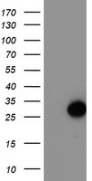 HEK293T cells were transfected with the pCMV6-ENTRY control (Left lane) or pCMV6-ENTRY ARL11 (Right lane) cDNA for 48 hrs and lysed