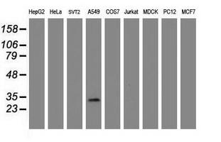 Western blot analysis of extracts (35ug) from 9 different cell lines by usin g anti-ZFAND5 monoclonal antibody (HepG2: human; HeLa: human; SVT2: mouse; A549: human; COS7: monkey; Jurkat: human; MDCK: canine; PC12: rat; MCF7: human).