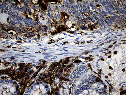 m11984 anti plac8 mouse monoclonal antibody clone id oti2e10 ihc testing 6