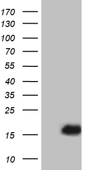 HEK293T cells were transfected with the pCMV6-ENTRY control (Left lane) or pCMV6-ENTRY PLAC8 (Right lane) cDNA for 48 hrs and lysed