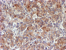 m12013 1 anti ndufaf7 mouse monoclonal antibody clone id oti4a5 ihc testing 11