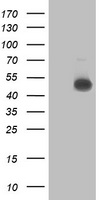 HEK293T cells were transfected with the pCMV6-ENTRY control (Left lane) or pCMV6-ENTRY C2orf56 (Right lane) cDNA for 48 hrs and lysed