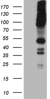 HEK293T cells were transfected with the pCMV6-ENTRY control (Left lane) or pCMV6-ENTRY RUSC2 (Right lane) cDNA for 48 hrs and lysed. Equivalent amounts of cell lysates (5 ug per lane) were separated by SDS-PAGE and immunoblotted with anti-RUSC2 (1:2000).