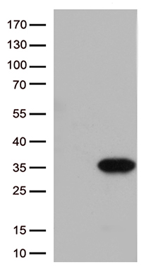 HEK293T cells were transfected with the pCMV6-ENTRY control (Left lane) or pCMV6-ENTRY ITGB1BP3 (Right lane) cDNA for 48 hrs and lysed. Equivalent amounts of cell lysates (5 ug per lane) were separated by SDS-PAGE and immunoblotted with anti-ITGB1BP3 (1:2000).