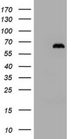 HEK293T cells were transfected with the pCMV6-ENTRY control (Left lane) or pCMV6-ENTRY ZKSCAN4 (Right lane) cDNA for 48 hrs and lysed