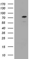 HEK293T cells were transfected with the pCMV6-ENTRY control (Left lane) or pCMV6-ENTRY CCDC93 (Right lane) cDNA for 48 hrs and lysed. Equivalent amounts of cell lysates (5 ug per lane) were separated by SDS-PAGE and immunoblotted with anti-CCDC93.