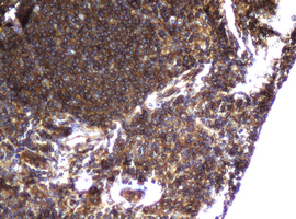 m12181 anti ccdc93 mouse monoclonal antibody clone id oti6e11 ihc testing 4