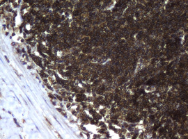 m12181 anti ccdc93 mouse monoclonal antibody clone id oti6e11 ihc testing 5