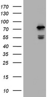 HEK293T cells were transfected with the pCMV6-ENTRY control (Left lane) or pCMV6-ENTRY CCDC93 (Right lane) cDNA for 48 hrs and lysed