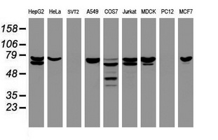 Western blot analysis of extracts (35ug) from 9 different cell lines by using anti-CCDC93 monoclonal antibody (HepG2: human; HeLa: human; SVT2: mouse; A549: human; COS7: monkey; Jurkat: human; MDCK: canine; PC12: rat; MCF7: human)