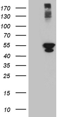 m12220 anti psmd5 mouse monoclonal antibody clone id oti8b1 wb testing 1