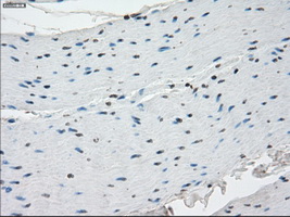m12258 anti ssx2 mouse monoclonal antibody clone id oti4d10 ihc testing 10