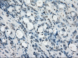 m12258 anti ssx2 mouse monoclonal antibody clone id oti4d10 ihc testing 11