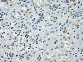 m12258 anti ssx2 mouse monoclonal antibody clone id oti4d10 ihc testing 12