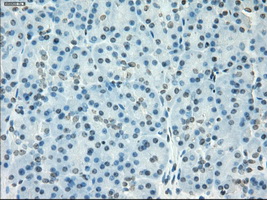 m12258 anti ssx2 mouse monoclonal antibody clone id oti4d10 ihc testing 4