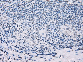 m12258 anti ssx2 mouse monoclonal antibody clone id oti4d10 ihc testing 5