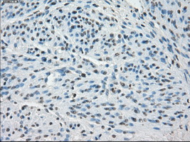 m12258 anti ssx2 mouse monoclonal antibody clone id oti4d10 ihc testing 6