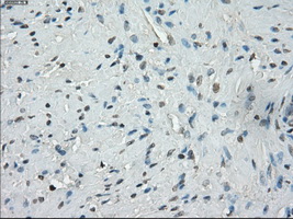 m12258 anti ssx2 mouse monoclonal antibody clone id oti4d10 ihc testing 7