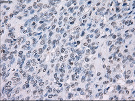 m12258 anti ssx2 mouse monoclonal antibody clone id oti4d10 ihc testing 8