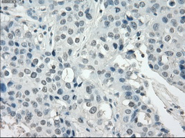 m12258 anti ssx2 mouse monoclonal antibody clone id oti4d10 ihc testing 9