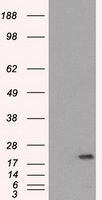 HEK293T cells were transfected with the pCMV6-ENTRY control (Left lane) or pCMV6-ENTRY SSX2 (Right lane) cDNA for 48 hrs and lysed
