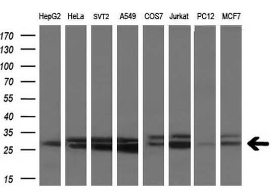 Western blot analysis of extracts (10ug) from 8 different cell lines by using anti-SSX2 monoclonal antibody at 1:200 dilution