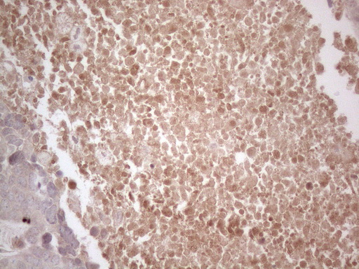 m12292 anti b4galt4 mouse monoclonal antibody clone id oti8b6 ihc testing 4