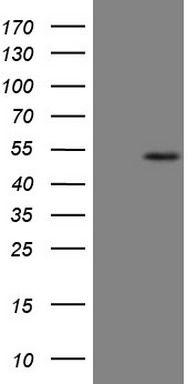 HEK293T cells were transfected with the pCMV6-ENTRY control (Left lane) or pCMV6-ENTRY B4GALT4 (Right lane) cDNA for 48 hrs and lysed