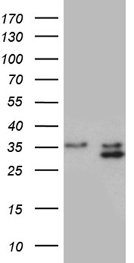 HEK293T cells were transfected with the pCMV6-ENTRY control (Left lane) or pCMV6-ENTRY PLSCR2 (Right lane) cDNA for 48 hrs and lysed