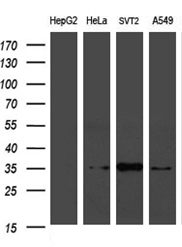 Western blot analysis of extracts (35ug) from 4 different cell lines by using anti-PLSCR2 monoclonal antibody (1:500)