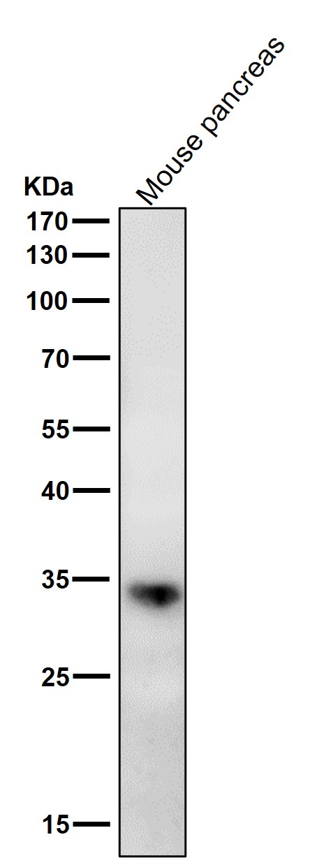 All lanes use the Antibody at 1:2K dilution for 1 hour at room temperature.
