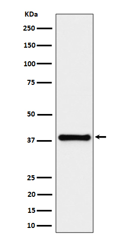 Western blot analysis of UCHL5IP expression in HeLa cell lysate
