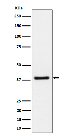 Western blot analysis of UCHL5IP expression in Jurkat cell lysate