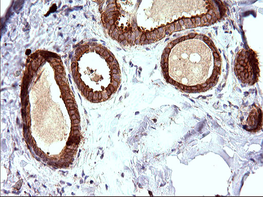 Immunohistochemical staining of paraffin-embedded Human breast tissue within the normal limits using anti-HAUS7 mouse monoclonal antibody