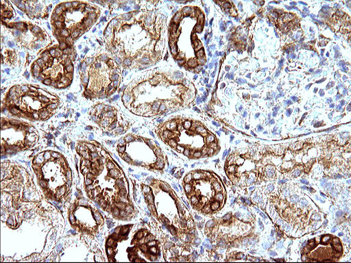 m12338 anti uchl5ip haus7 mouse monoclonal antibody clone id oti1e8 ihc testing 4