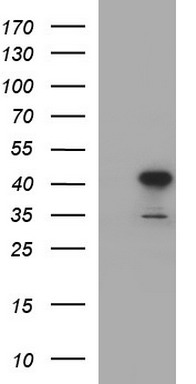 HEK293T cells were transfected with the pCMV6-ENTRY control (Left lane) or pCMV6-ENTRY HAUS7 (Right lane) cDNA for 48 hrs and lysed