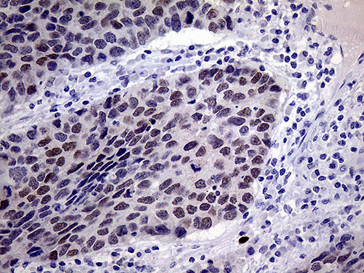 m12386 anti tsen34 mouse monoclonal antibody clone id oti6b3 ihc testing 2