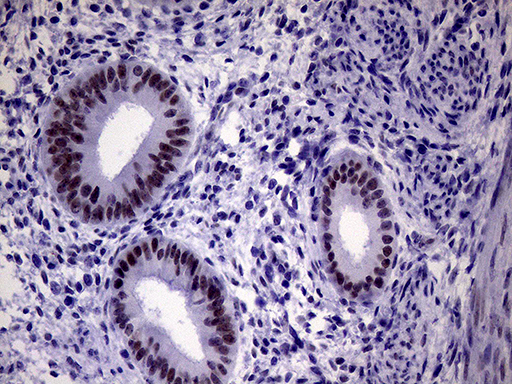 m12386 anti tsen34 mouse monoclonal antibody clone id oti6b3 ihc testing 3