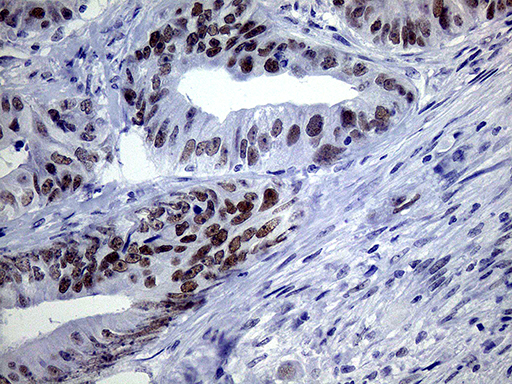 m12386 anti tsen34 mouse monoclonal antibody clone id oti6b3 ihc testing 4