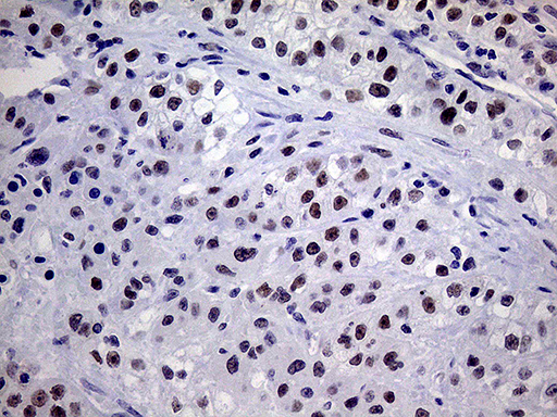m12386 anti tsen34 mouse monoclonal antibody clone id oti6b3 ihc testing 5