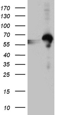 HEK293T cells were transfected with the pCMV6-ENTRY control (Left lane) or pCMV6-ENTRY RBMS3 (Right lane) cDNA for 48 hrs and lysed